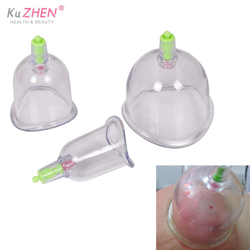 伝統的な 3 カップ kangzhu u 湾曲した真空吸引関 - Medical Laboratory Science のレビューと価格